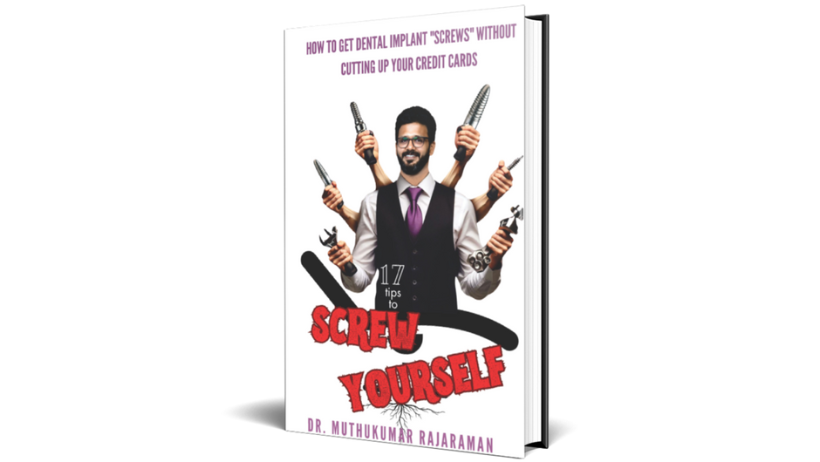 17 Tips to Screw Yourself – A Dentist’s Ultimate Guide to Dental Implants Unveiled!